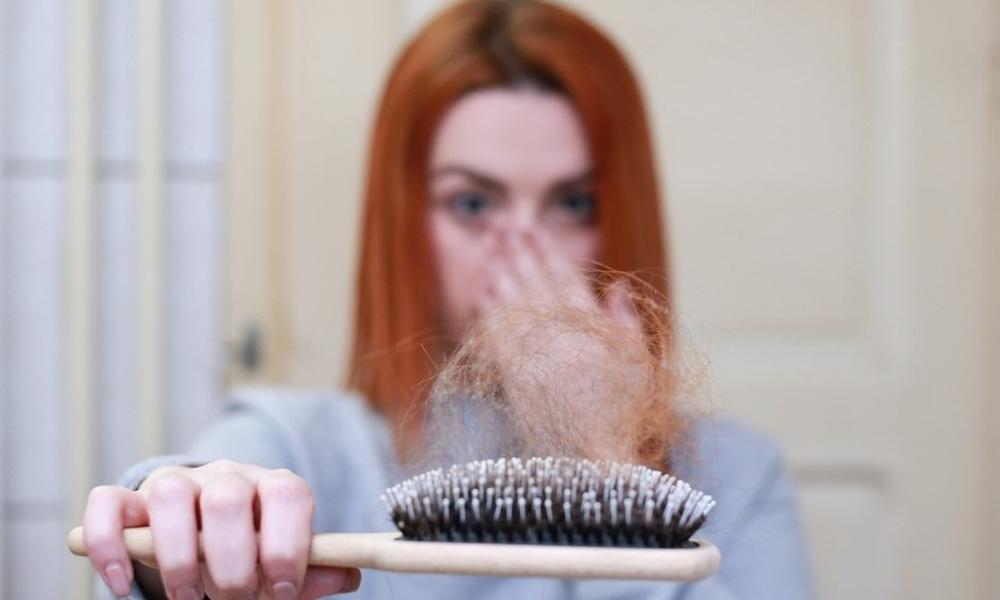 Hair Loss Hair Loss